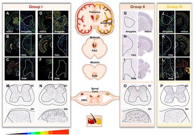 Emerging Trends in Pain Modulation by Metabotropic Glutamate Receptors